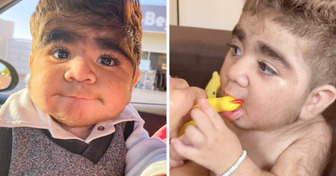 Meet Miguel, the Baby Boy Who Stole Hearts Because He Has a “Beard Better Than Most Men”