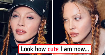 Madonna Responds to Critics With a Pic After ’’Swelling From Surgery’’ Has Gone Down