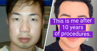 A Guy With Phenomenal Plastic Surgery Results Draws a Surprising Conclusion About Happiness