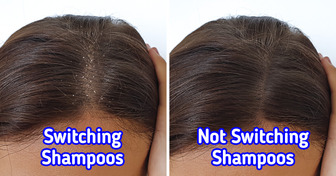 10 Everyday Hair Habits That Could Be Hurting Your Scalp