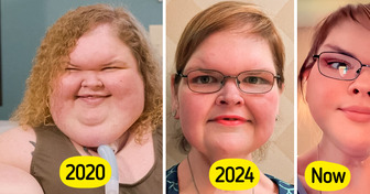“1000-lb Sisters” Star Debuts a New Look After Skin Removal Surgery, Leaves Fans Shocked