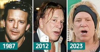 A Tragic Story Behind Mickey Rourke’s Changing Face That Nearly Destroyed Himself