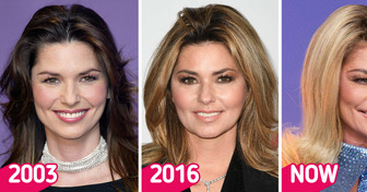 “What Happened to Her Face?” Shania Twain Surprises Fans Who Can’t Recognize Her