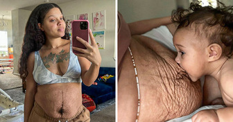 A Woman Shows the Raw Truth of Postpartum Bodies