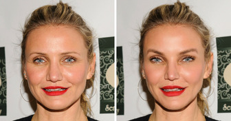 What 10 Naturally Beautiful Stars Would Look Like If They Underwent the Trendiest Cosmetic Procedures