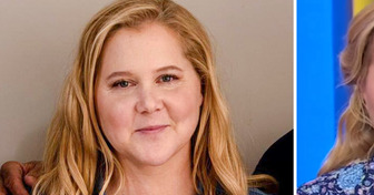 “What Happened to Her Face?” Amy Schumer Leaves Fans Concerned as New Pics Surface