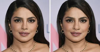 What 9 Celebrities Would Look Like Without Drastic Beauty Procedures