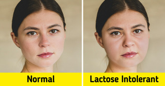 12 Signs Your Body Could Be Sending About Lactose Intolerance