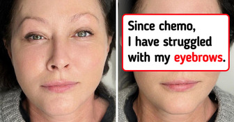 Shannen Doherty Shares ’What Cancer Can Look Like’ in Video Before Surgery to Remove Tumor From Head