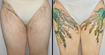 15 People Who Turned Their Scars Into Beautiful Tattoos, Thanks to This Vietnamese Artist
