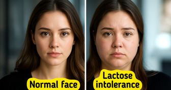 9 Warning Signs You Might Be Lactose Intolerant