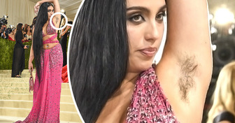 14 Celebrities That Proved Body Hair Is Nothing to Be Ashamed Of
