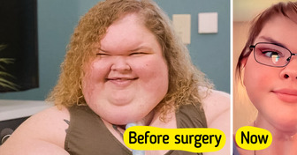 “Proud of You,” 1000-lb Sisters Star’s Incredible Before and After Skin Removal Surgery