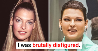Linda Evangelista Opens Up About Her Journey to Recovery After Her Botched Plastic Surgery