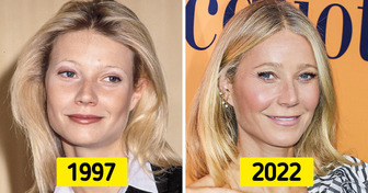 15 Celebrities Who Look Like They’ve Taken a Youth Potion