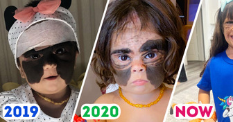 A Girl, Who Was Born With a “Batman” Birthmark on Her Face, Is All Grown Up Now, Mom Shares a Heartwarming Update