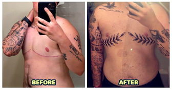 16 People Who Turned Their Scars Into a Powerful Story to Be Told