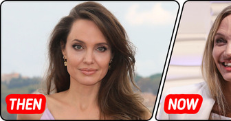 ’’Looks Terrible,’’ Angelina Jolie Creates Stir in New Appearance— Everyone Is Saying One Thing