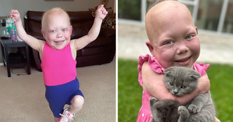 I Am 10 With the Body of a One-Year-Old and I Have Survived Dozens of Surgeries