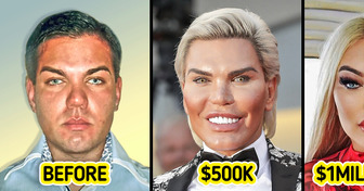 I Spent $1MILLION on Plastic Surgery to Look Like a Barbie Doll