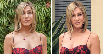 “Tired and Aged,” Doctor Explains What Happened to Jennifer Aniston’s Face