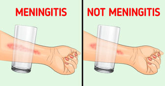 8 Symptoms of Meningitis That Every Parent Should Know About