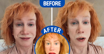 Kathy Griffin SHOCKS Fans After Showing the Result of Her Lip Tattoo