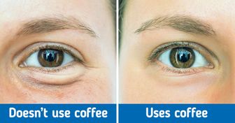 8 Tips to Reduce Black Circles and Tiredness Under the Eyes