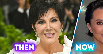 “Best Facelift Ever,” Kris Jenner Looks Half Her Age After Surgery—People Think She Looks Like Kim