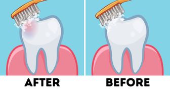 Dentists Finally Solve the Debate on Should You Brush Your Teeth Before or After Breakfast