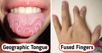 17 People Shared Their Unique Genetics That Redefine Beauty