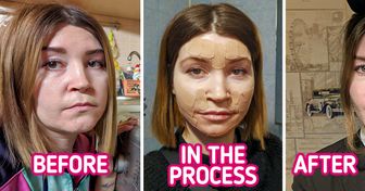 14 People Who Are Ready to Tell You the Whole Truth About the Beauty Procedures They Used