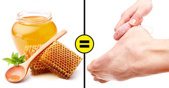 8 Home Remedies to Remove Cracked Heels and Get Beautiful Feet