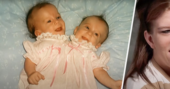 Conjoined Twins Who Paid Double College Fees Now Earn One Salary, Sparking Debate