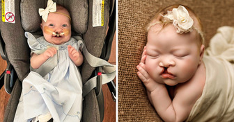 A Photo of a Baby With a Beautiful Cleft Lip Goes Viral, and Her Parents Reveal the Remarkable Story