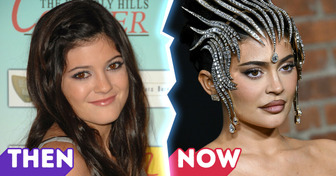 “I Don’t Want My Daughter to Do That,” Kylie Jenner Reveals Her Plastic Surgery Regrets