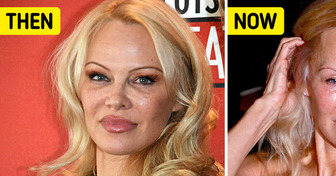 Pamela Anderson Ditches Makeup at Major Award Show, Sparks Debate