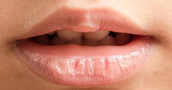 What Happens to Your Lips When You Use Lip Balm Too Often