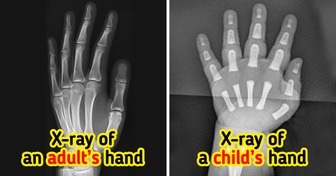 15 X-Rays That Uncover a Hidden World We Can’t See