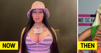Nicki Minaj Says She Regrets Her Plastic Surgeries After Taking a Look at Her Oldest Photos