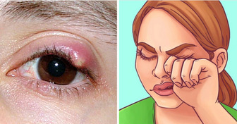 10 Health Signs Your Eyes Might Reveal About Your Body