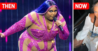 Lizzo Flaunts Major Transformation, but Fans Are Worried