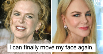 Nicole Kidman Reveals the Secret to Her Age-Defying Looks: “I Tried Botox, but I Got Out of It”