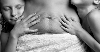 A Photographer Shows a Woman’s Body After Pregnancy, and It’s Not What We See in Fashion Magazines