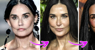 Experts Explain the Mystery of What Might Have Happened to Demi Moore’s Face