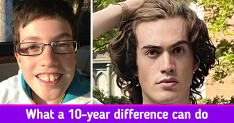 10+ People Who Went to Any Extent to Change Their Appearance