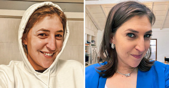 Mayim Bialik Reveals Why She Got Her First Ever Cosmetic Treatment at 42