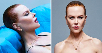 Nicole Kidman, 56, Creates Buzz For Not Looking Age Appropriate: «So Desperate to Hang On to Her Youth»