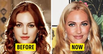 What Celebs Looked Like Before Tinkering With Their Appearance