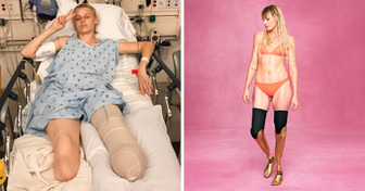 “I Lost Both Of My Legs Because Of A Tampon”, Lauren Wasser Defied the Odds and Became a Prominent Model